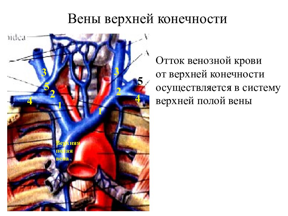 Покалывание в вене. Подключичная Вена анатомия схема. Верхняя полая Вена плечеголовные вены. Плечеголовная Вена анатомия. Верхняя полая Вена топография.