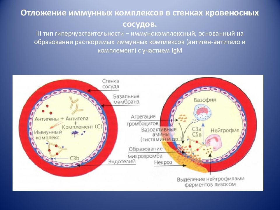 Иммунный комплекс. Иммунокомплексный Тип гиперчувствительности. Схема образования иммунных комплексов. Отложение иммунных комплексов. III Тип – иммунокомплексный.