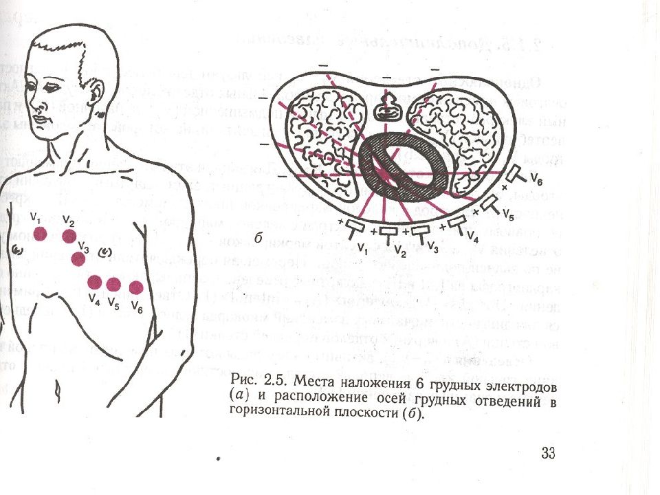 Экг наложение картинки