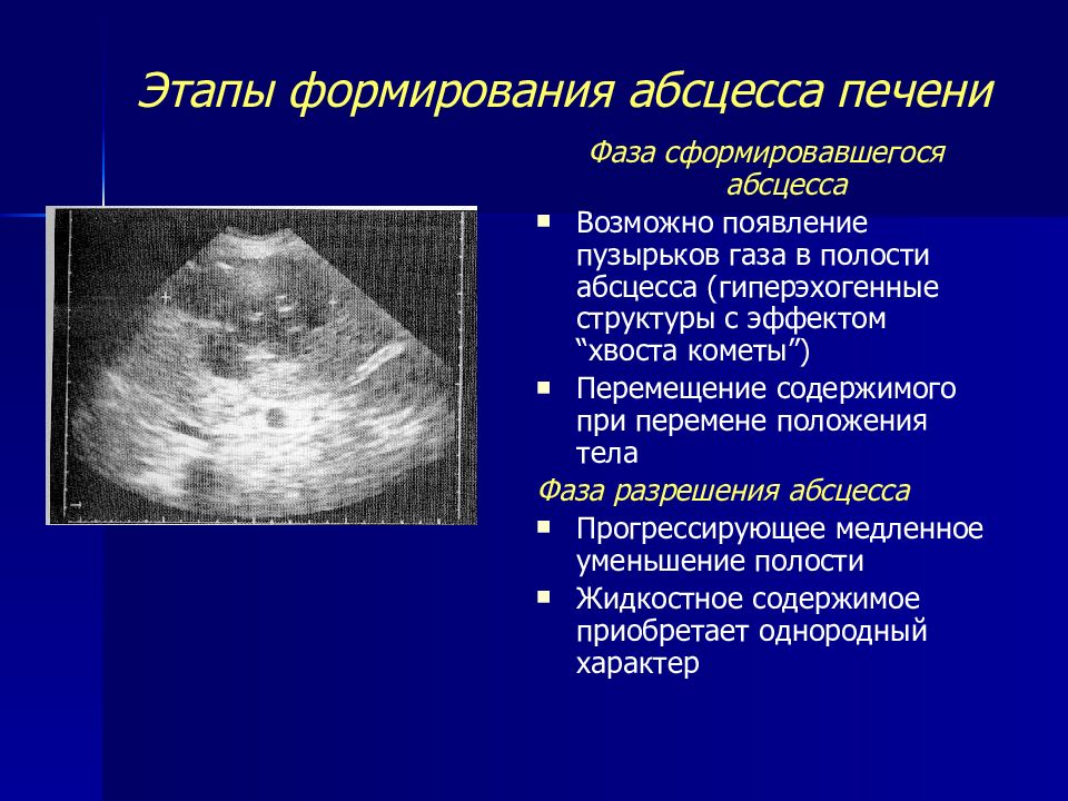 Абсцесс печени узи картина