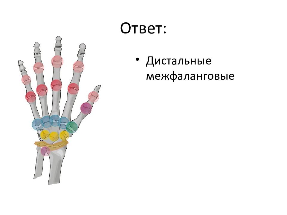 Межфаланговые суставы. Дистальные межфаланговые. Дистальные межфаланговые суставы. Дистальные межфаланговые пальцы. Инъекция в дистальные межфаланговые суставы.