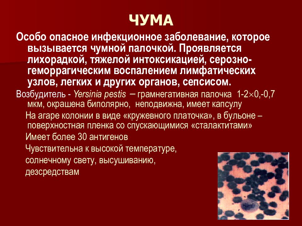 Какие особо опасные. Чума особо опасная инфекция. Особо опасные инфекции холера.