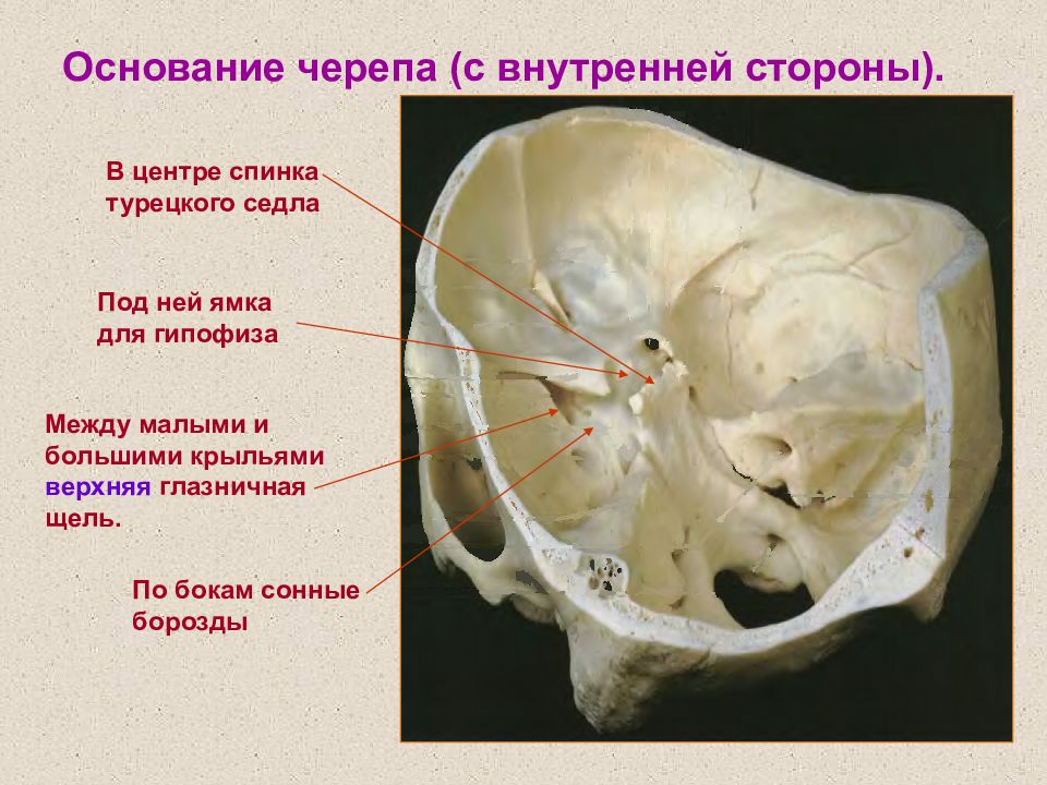 Гипофизарная ямка. Турецкое седло клиновидной кости черепа. Турецкое седло анатомия черепа. Клиновидная кость Сонная борозда. Спинка турецкого седла.