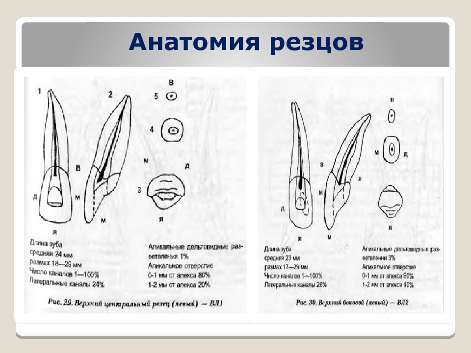 Резцов верхней челюсти