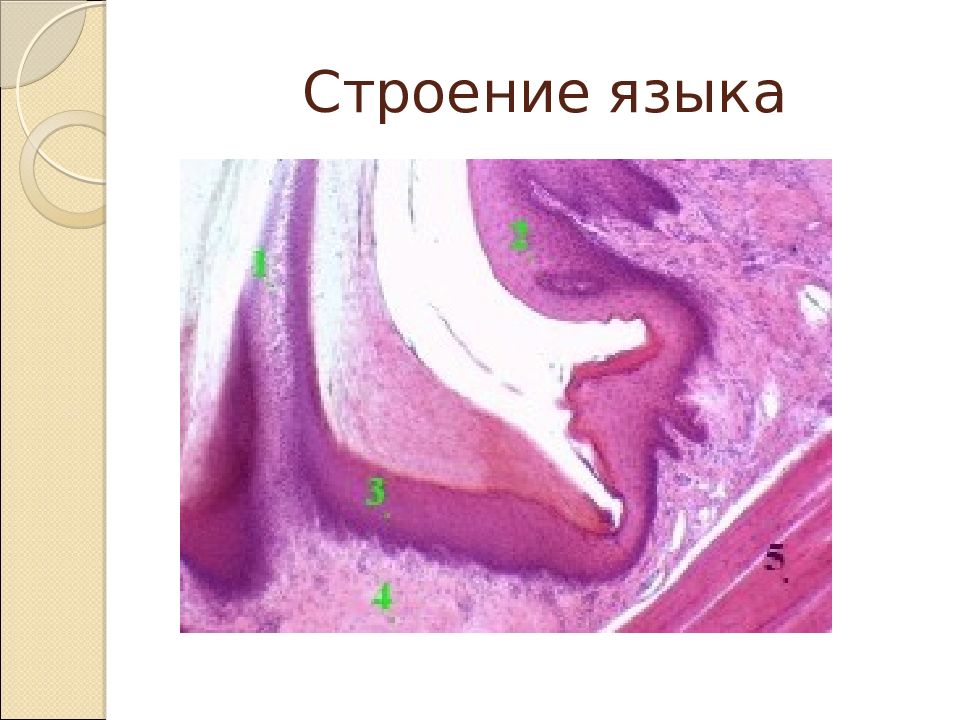 Клетки слизистой полости рта. Слизистая полости рта гистология. Эпителий ротовой полости. Гиперемированная слизистая оболочка рта.