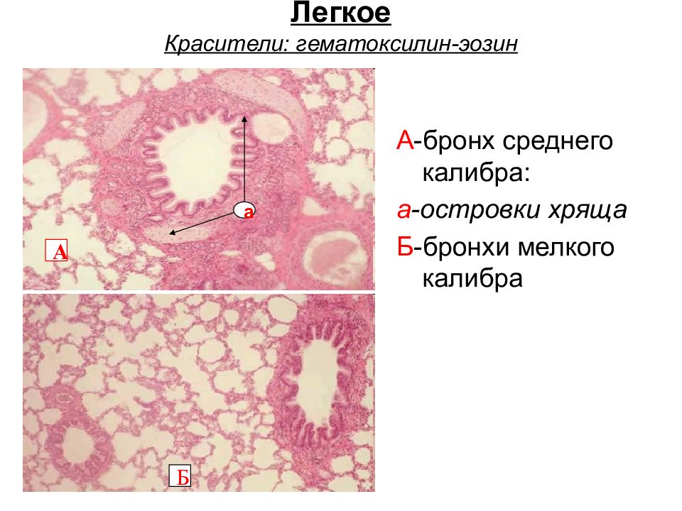 Легкое гистология рисунок