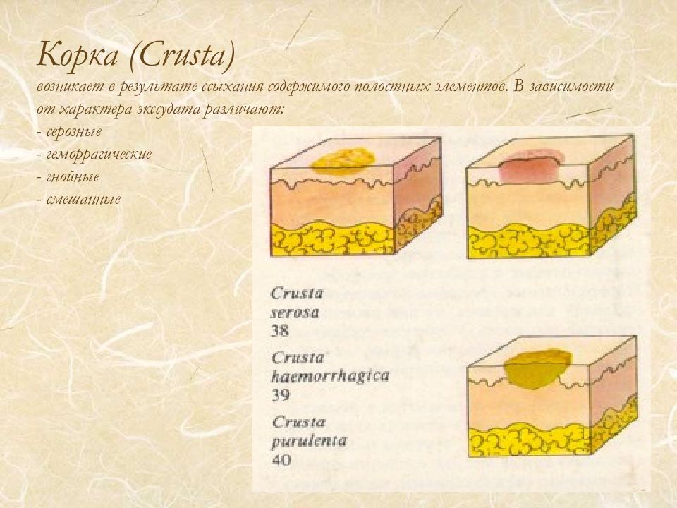 Элементы сыпи. Корка вторичный морфологический элемент. Вторичные морфологические элементы кожи корка. Первичные полостные элементы кожи. Первичные морфологические элементы гнойничок.