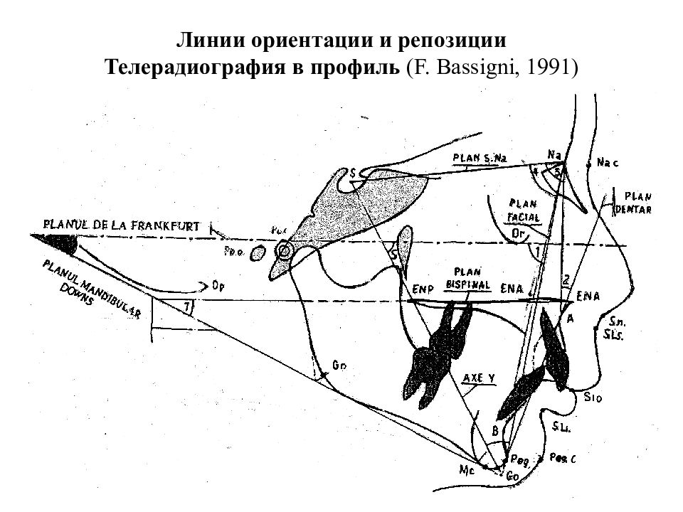 Линия ориентации. Телерадиография.