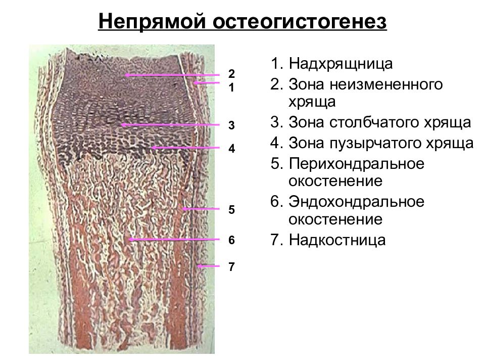 Непрямой остеогенез. Развитие кости на месте гиалинового хряща препарат гистология. Развитие кости на месте гиалинового хряща препарат. Развитие кости на месте хряща гистология препарат. Образование кости на месте хряща гистология препарат.