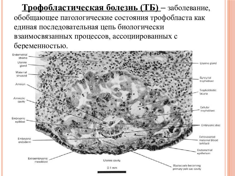 Трофобластическая болезнь презентация