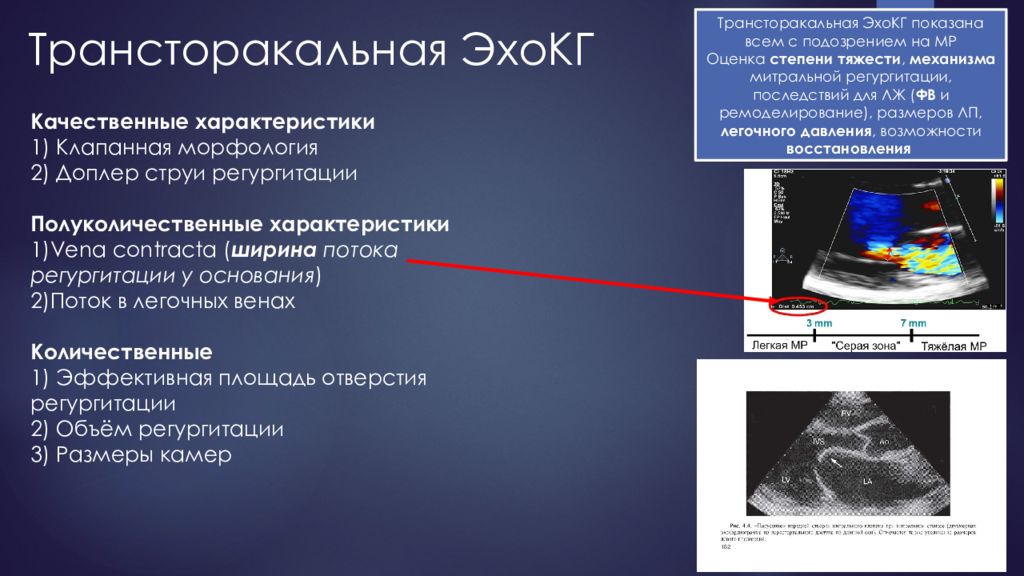 Эхо кг это. УЗИ сердца (трансторакальная эхокардиография. Трансторакальная допплер эхокардиография. Трасторакальная Эхо кг. Трансотаракльная Эхо-кг.