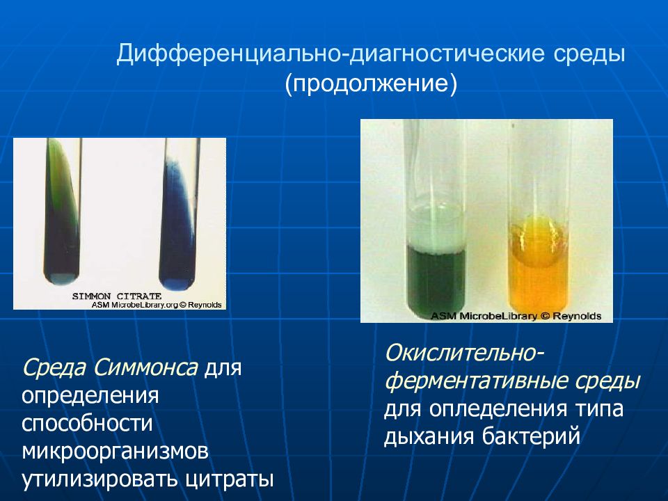 Дифференциально диагностические. Дифференциально-диагностические питательные среды. Дифференциально- диагностическая среда бактерий. Дифференциальные диагностические среды микробиология. Дифференциально-диагностические питательные среды микробиология.