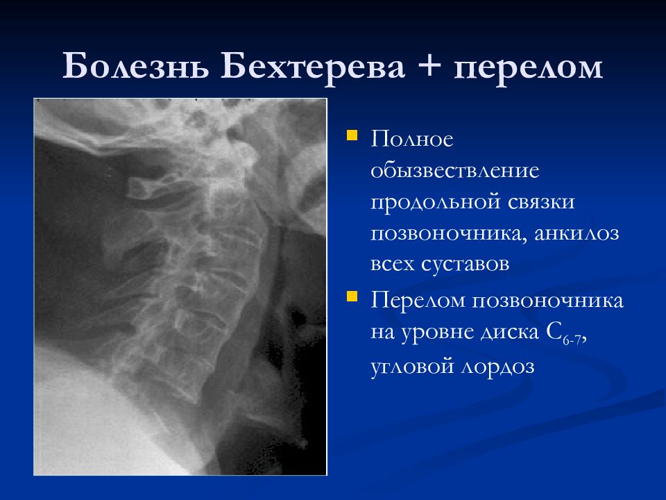 Лучевая диагностика позвоночник презентация