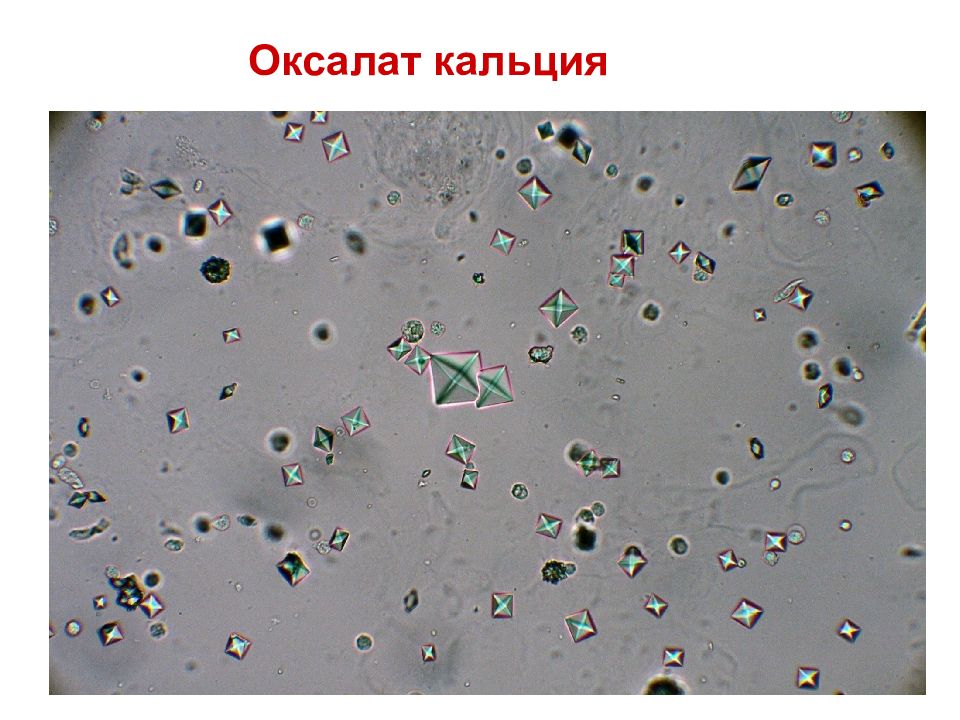 Микроскопия осадка мочи фото с описанием