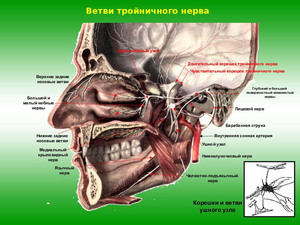 Лицевой нерв челюсти. Гассеров узел тройничного. Двигательный нерв тройничного нерва. Двигательный корешок тройничного нерва. Тройничного нерва ветви челюсти.