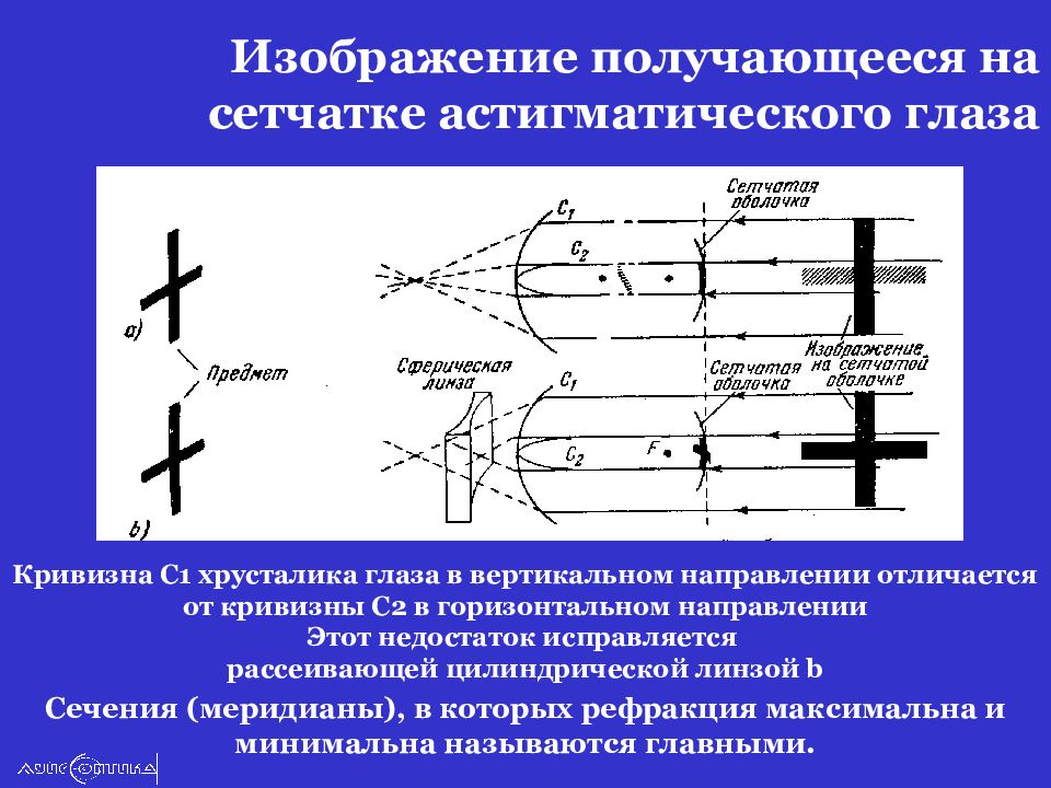 Вертикальное направление. Изображение внешних объектов на сетчатке астигматического глаза.. Главные сечения астигматического глаза. Главные оптические меридианы астигматического глаза. Астигматическая линза сечение.