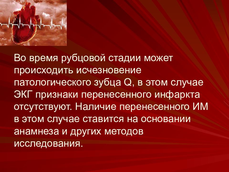 Наличие перенести. Рубцовой стадии инфаркта. Самый стойкий признак перенесенного в прошлом глубокого инфаркта.