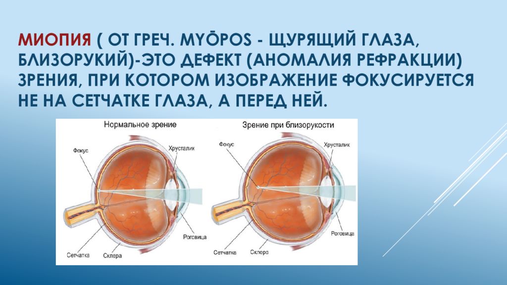 Измерение рефракции