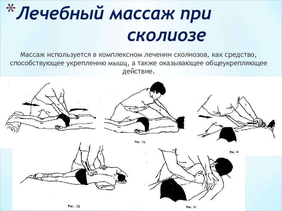 Массаж при сколиозе. Массаж при сколиозе 1 степени у подростков. Массаж при сколиозе позвоночника у детей 1 степени. Массаж при s образном сколиозе 1 степени. Массаж при сколиозе техника выполнения спины у детей.