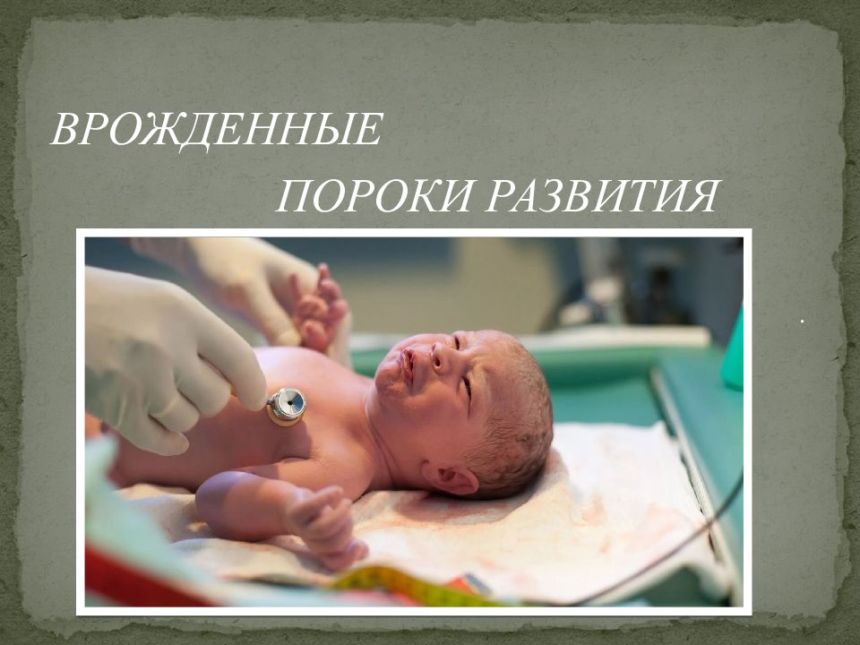 ВРОЖДЕННЫЕ ПОРОКИ РАЗВИТИЯ .