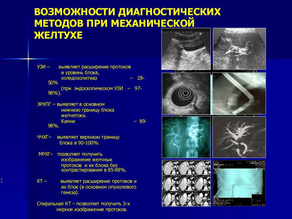 План обследования пациента с желтухой