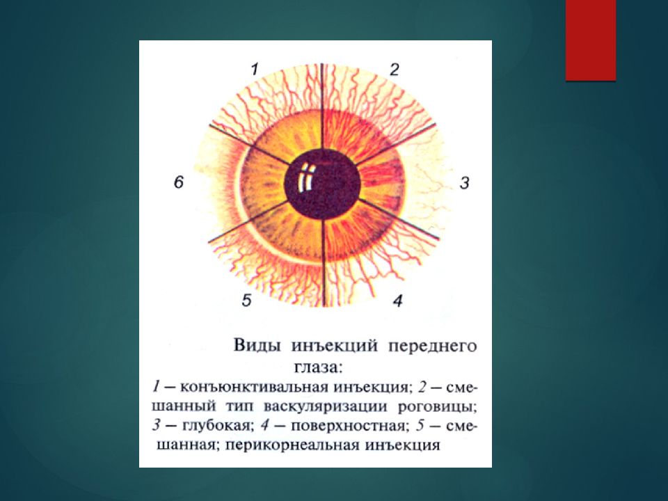 Патология сосудистой оболочки презентация