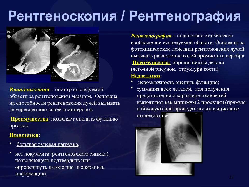 Гетерография это