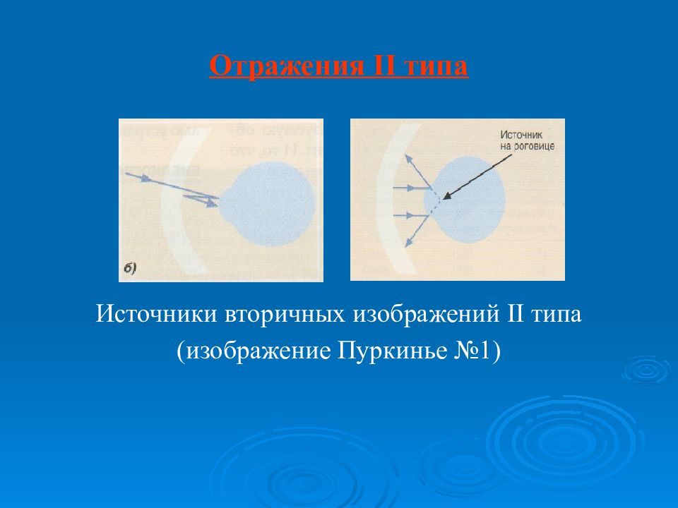 Отражается вид. Отражение от поверхности линз. Отражение поверхности очковой линзы.