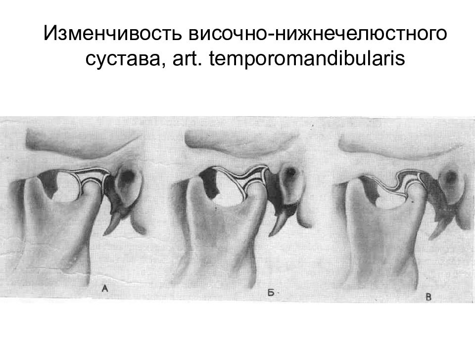 Челюстной сустав