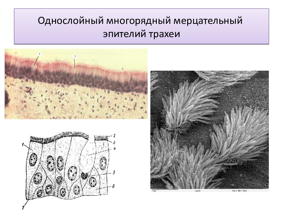 Мерцательный эпителий рисунок