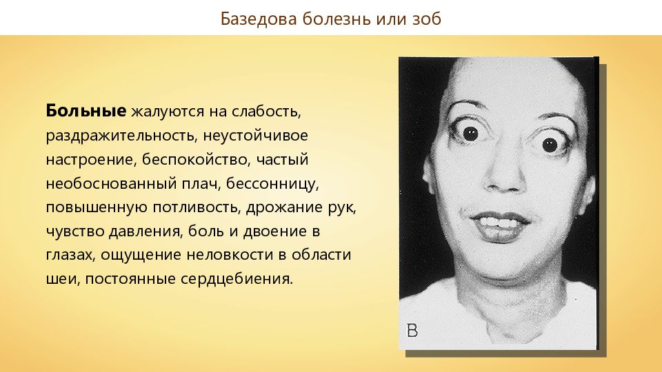 Эндокринные заболевания. Работа эндокринной системы и её нарушения. Известные люди с заболеванием эндокринной системы. Заболевания эндокринной системы презентация 8 класс. Базедова болезнь функциональное нарушение эндокринной системы.