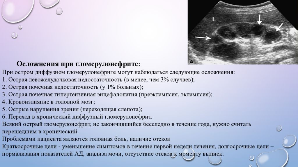 Для ультразвуковой картины почек при остром гломерулонефрите будет характерно