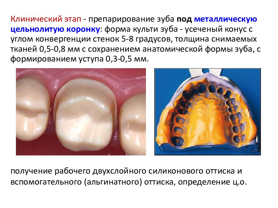 Искусственные коронки презентация