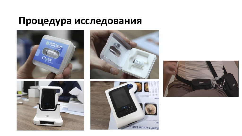 Капсульная эндоскопия презентация