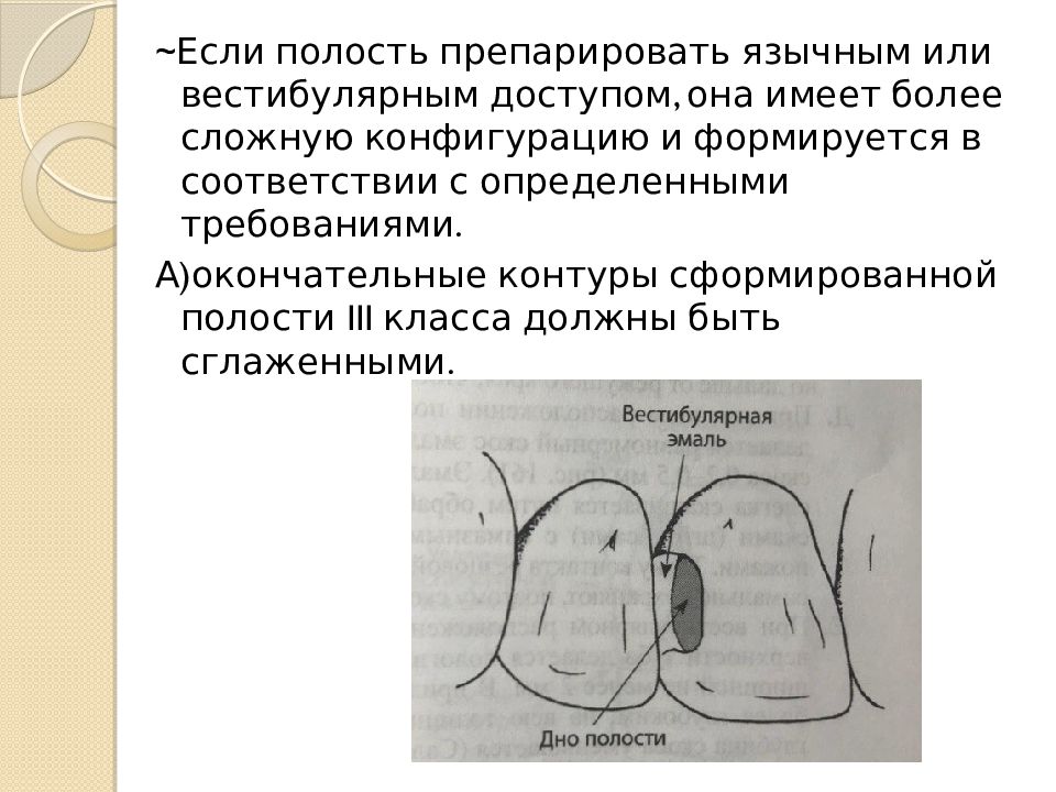 Классификация кариозных полостей по блэку презентация