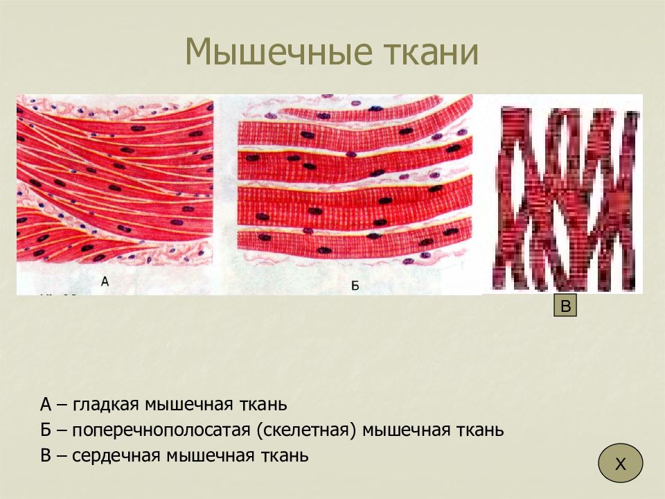 На рисунках изображены клетки ткани. Миоциты поперечно-полосатой ткани. Поперечнополосатая сердечная мышечная ткань рисунок. Поперечнополосатая и гладкая мышечная ткань. Клетка поперечно скелетной мышечной ткани.