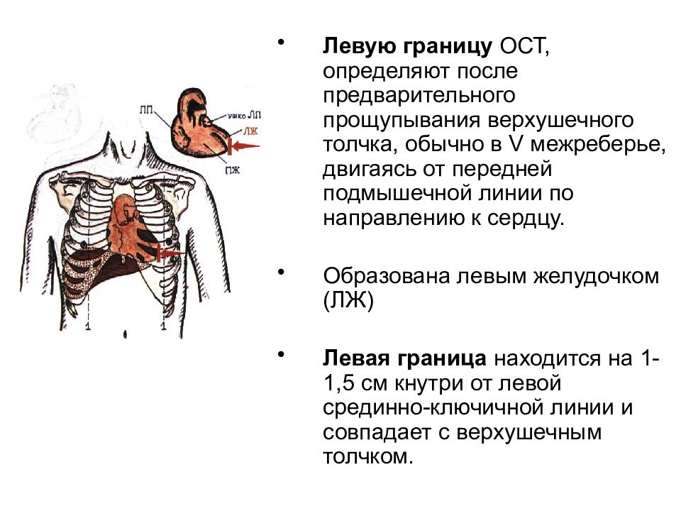 Перкуссия сердца схема