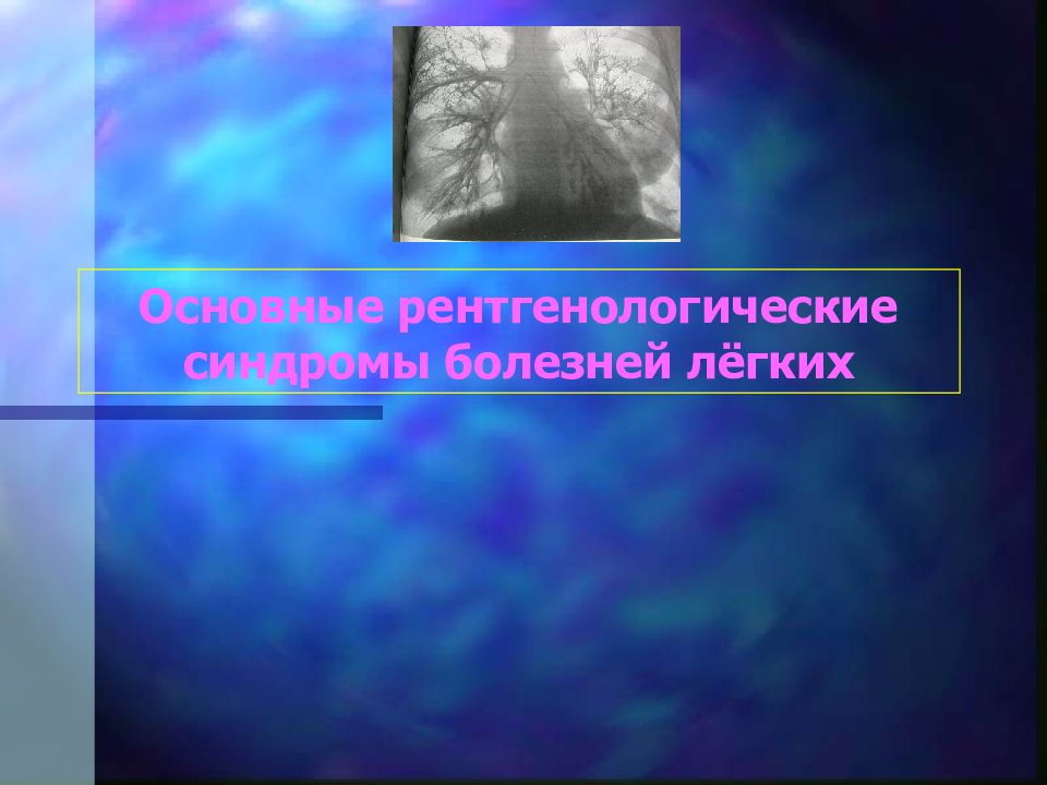 Основные рентгенологические синдромы болезней лёгких