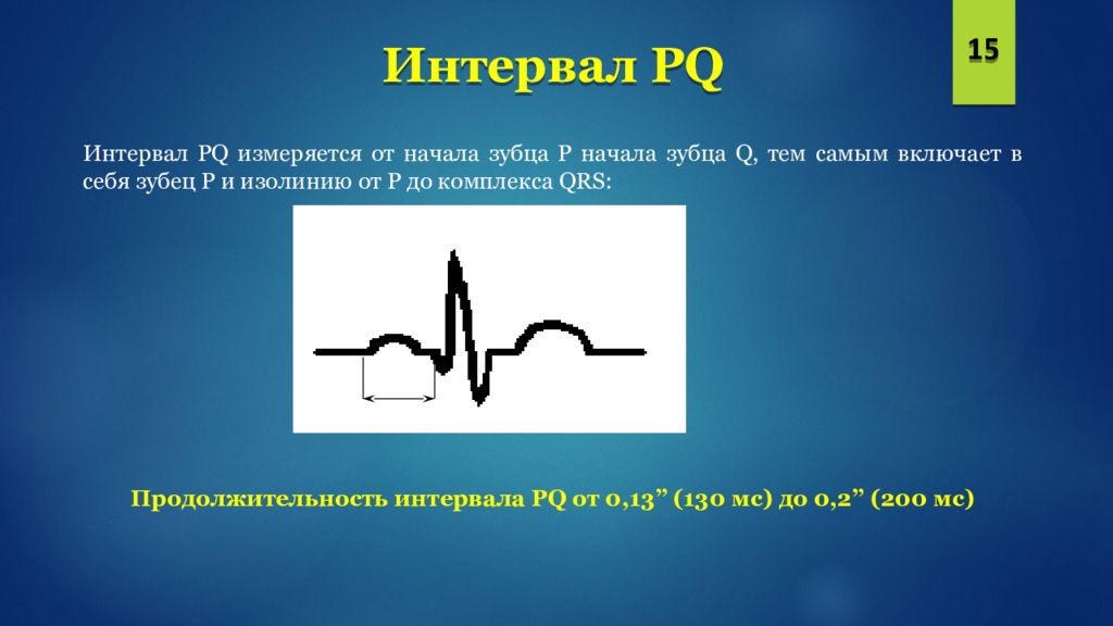 Увеличение интервала pq. ЭКГ для презентации. Интервал PQ. Интервал PQ измеряется. Интервал PQ характеризует.