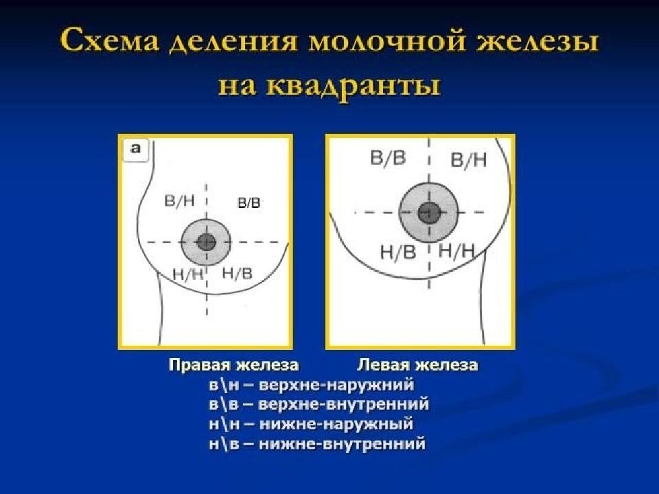 Квадранты молочной железы схема