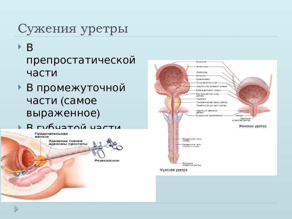 Схема мочеиспускательный канал