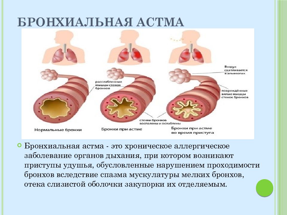 План массажа при бронхиальной астме