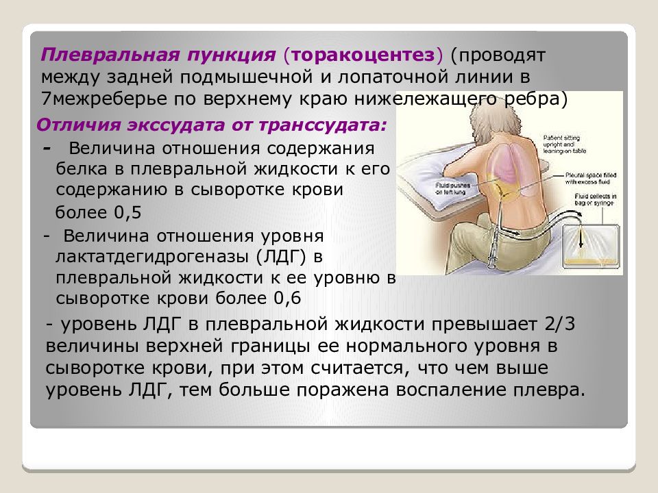 Если легких жидкость что можно. Плевральная пункция положение больного. Плевральная пункция гидроторакс. Эмпиема плевры пункция. Места пункции плевральной полости.