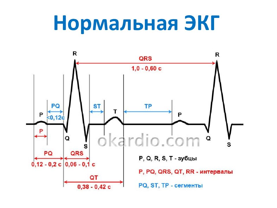 Экг человека. ЭКГ зубец р в норме и при патологии. Кардиограмма сердца расшифровка норма и патология. Показатели ЭКГ здорового человека. Нормы зубцов ЭКГ таблица.