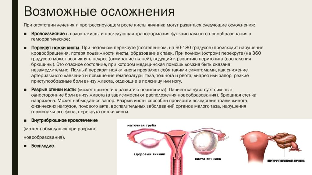 Аномалии развития яичников презентация