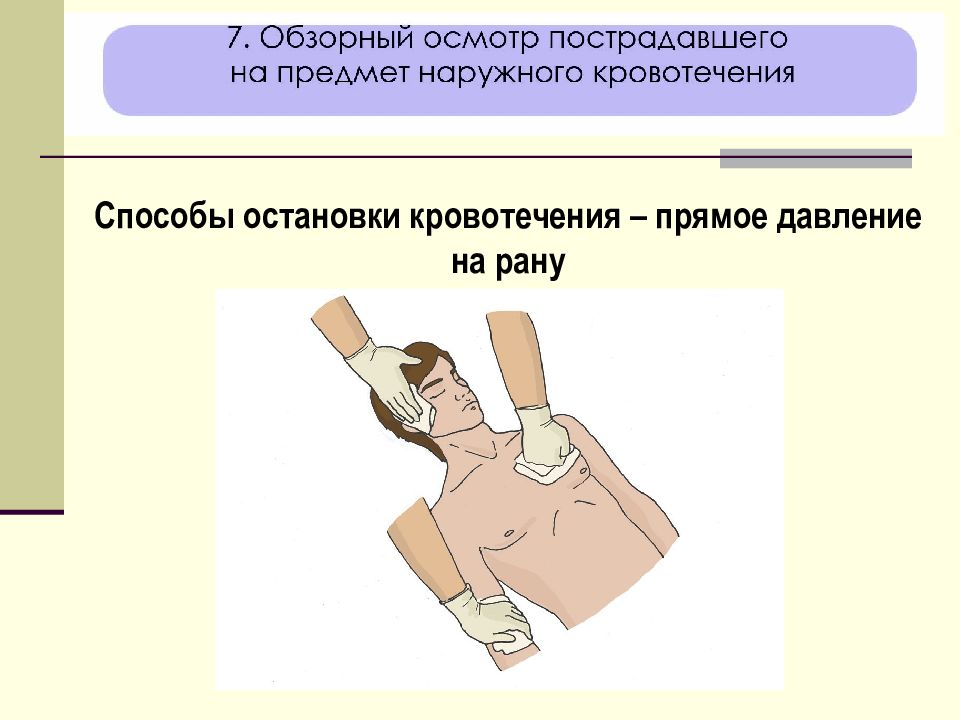 Обзорный осмотр пострадавшего. Прямое давление на рану. Прямое давление на рано. Способ остановки кровотечения «прямое давление на рану» …. Способ прямого давления на рану.