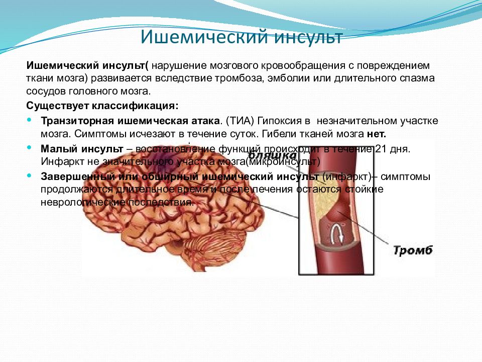 Острые нарушения мозгового кровообращения презентация