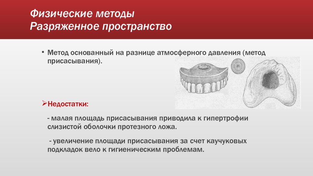 Способы фиксации съемных протезов. Физический метод фиксации протезов. Физические методы. Механические способы фиксации протезов.