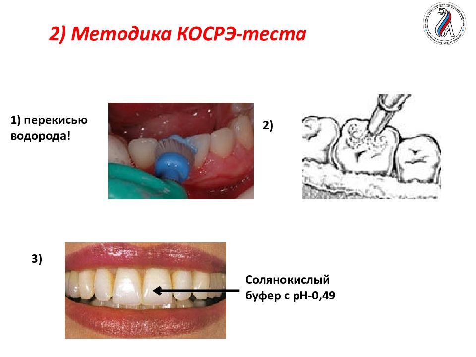 Косрэ тест. Тэр и Косрэ тест стоматология. Косрэ тест интерпретация. Косрэ-тест (определение, методика проведения).. Косрэ-тест в стоматологии как проводится.
