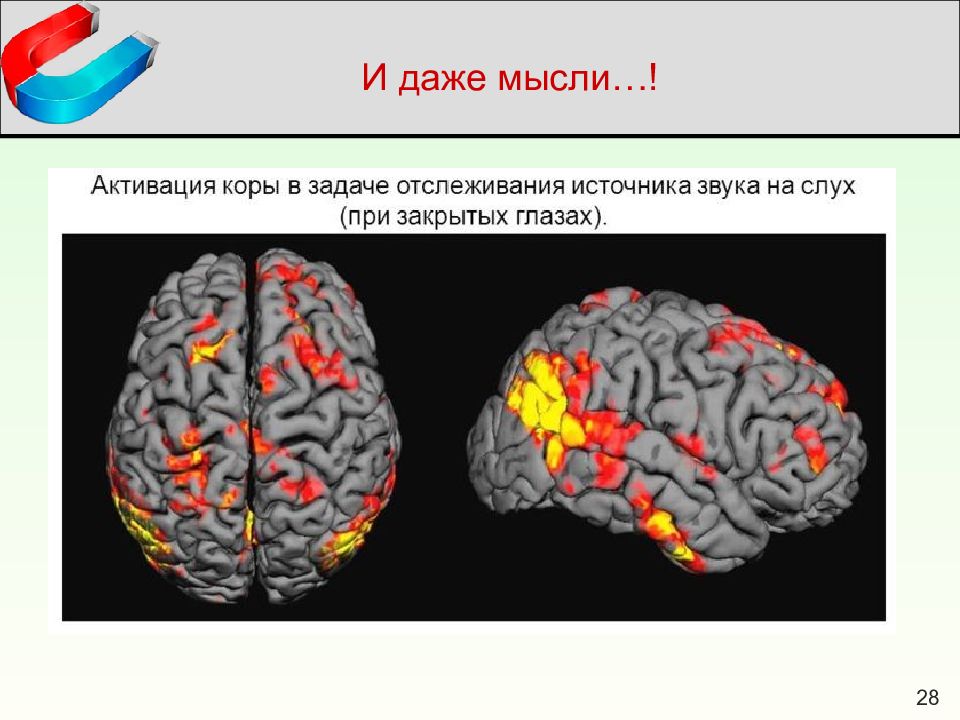 Функциональная мрт презентация